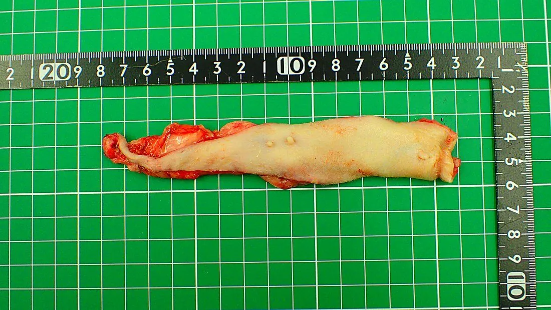 日本猫の乳腺腫瘍（乳腺がん） 12