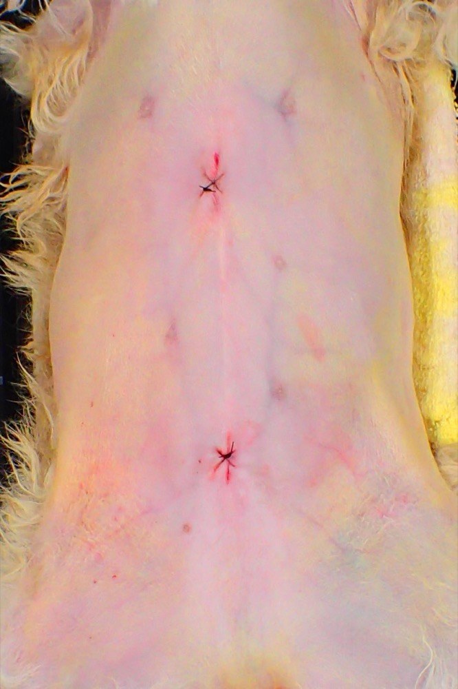 腹腔鏡下避妊手術の術創。5〜10mmの傷が2か所
