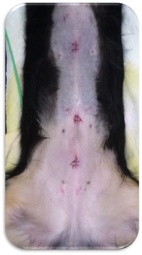 腹腔鏡下避妊手術の術創(3ポート)